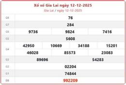 tính năng nổi bật soi cau xo so gia lai